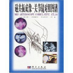 磁共振成像關節鏡對照圖譜 磁共振成像關節鏡對照圖譜