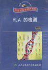 HLA的檢測 HLA的檢測