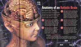 輕度弱智 輕度弱智