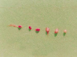 從結腸漿黏膜剝下的幼蟲