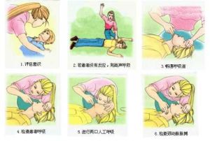 急救常識 急救常識