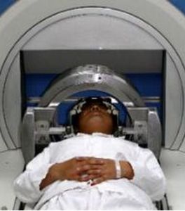 頭部伽瑪刀劑量分割治療 頭部伽瑪刀劑量分割治療