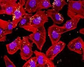 新型隱球菌腦膜炎 新型隱球菌腦膜炎