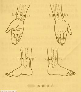 腕踝針法 腕踝針法