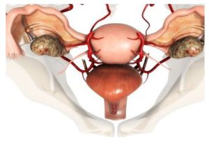 輸卵管阻塞