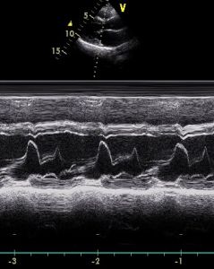 M型超聲心動圖 M型超聲心動圖