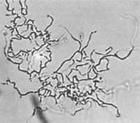 孢暗灰鏈黴菌