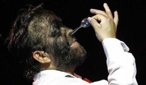 醫源性多毛症 醫源性多毛症