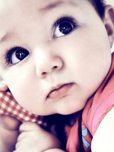 新生兒生理性黃疸