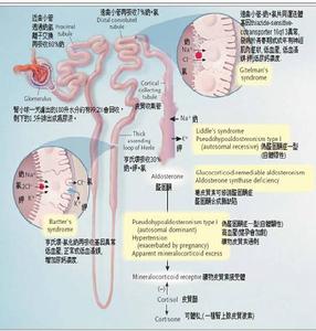 假性醛固酮減少症