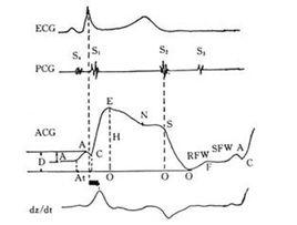 頸動脈搏動圖 頸動脈搏動圖
