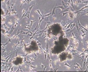 餾合真菌 餾合真菌