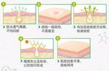痘痘貼原理圖