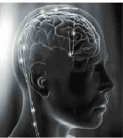 叢集性偏頭疼 叢集性偏頭疼