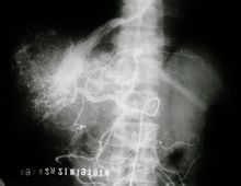 肝臟影像圖
