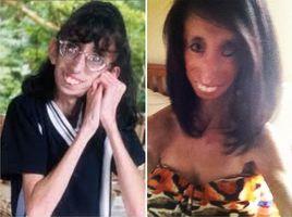 世界最醜女人 世界最醜女人