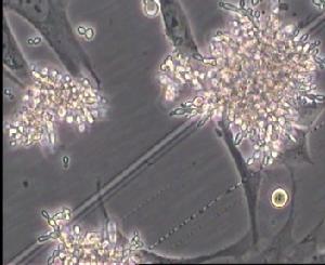 真菌細胞