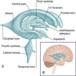 透明隔腔 透明隔腔