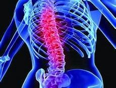 脊髓病變 脊髓病變