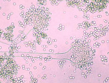真菌-電子顯微鏡下
