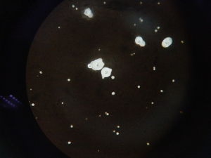 組織因子途徑抑制物 組織因子途徑抑制物
