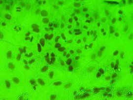 吉姆薩染色 吉姆薩染色