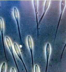 碘泡蟲科 碘泡蟲科