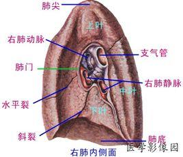 Wilson-Mikity綜合徵 Wilson-Mikity綜合徵