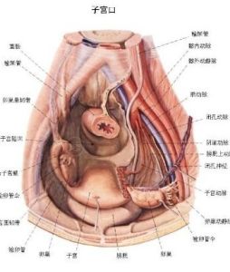 子宮肌瘤鈣化 子宮肌瘤鈣化