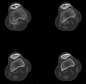 原發變態反應素