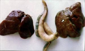 乾酪性壞死 乾酪性壞死