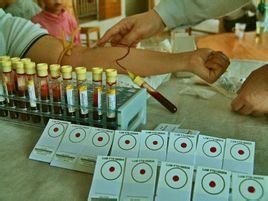 梅毒血清試驗 梅毒血清試驗