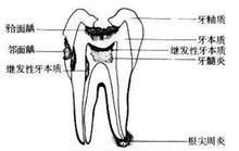 齲齒放線菌 齲齒放線菌