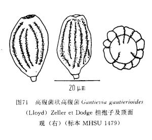 高腹菌狀高腹菌