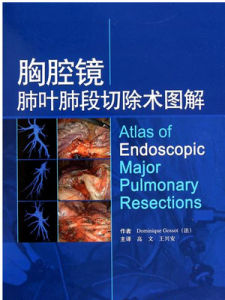 全肺切除術 全肺切除術