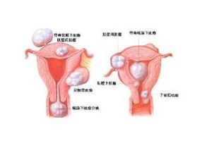 高催乳素血症 高催乳素血症