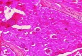 豬住肉孢子蟲病 豬住肉孢子蟲病