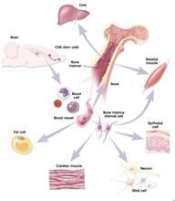神經系統結節病 神經系統結節病