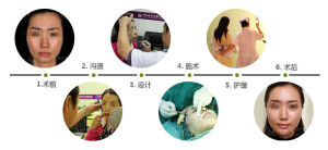 結構性脂肪移植面部綜合平衡術