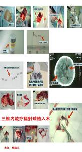 （圖）放射生物學臨床表現