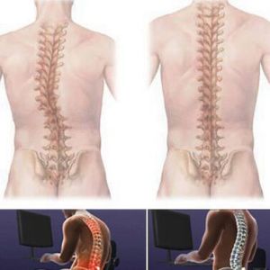 頸項強直 頸項強直