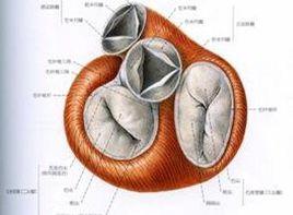 瓣膜增厚 瓣膜增厚