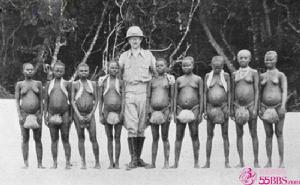 小人族[俾格米人別稱]