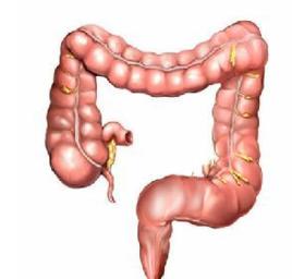 腸外營養的併發症 腸外營養的併發症