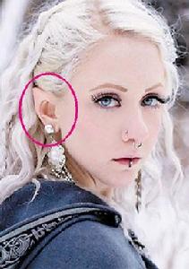 精靈耳整形 精靈耳整形