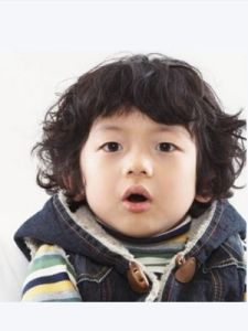 腺樣體面容 腺樣體面容