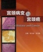 宮頸上皮內瘤變