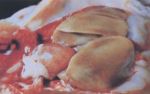 禽彎曲桿菌性肝炎——病雞剖解病變肝臟