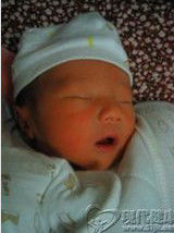 小兒黃疸 小兒黃疸