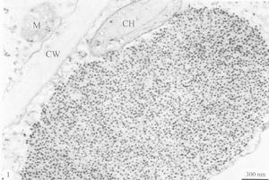 玉米褪綠矮縮病毒